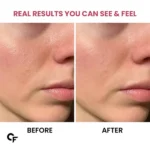 Carbamide Forte Collagen Supplements for Women & Men - Image 4